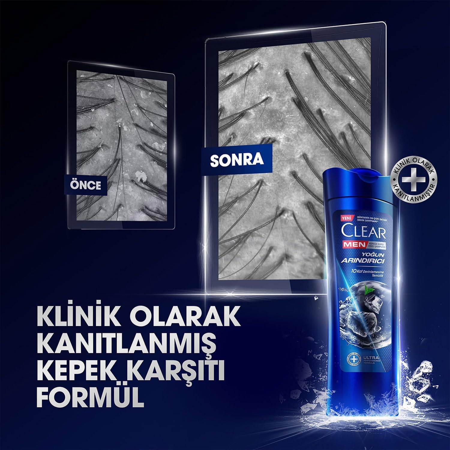 شامپو ضد شوره کلیر من مدل Yoğun Arındırıcı Kömür (زغال فعال) حجم 350 میلیلیتر | Clear Men - تصویر 5